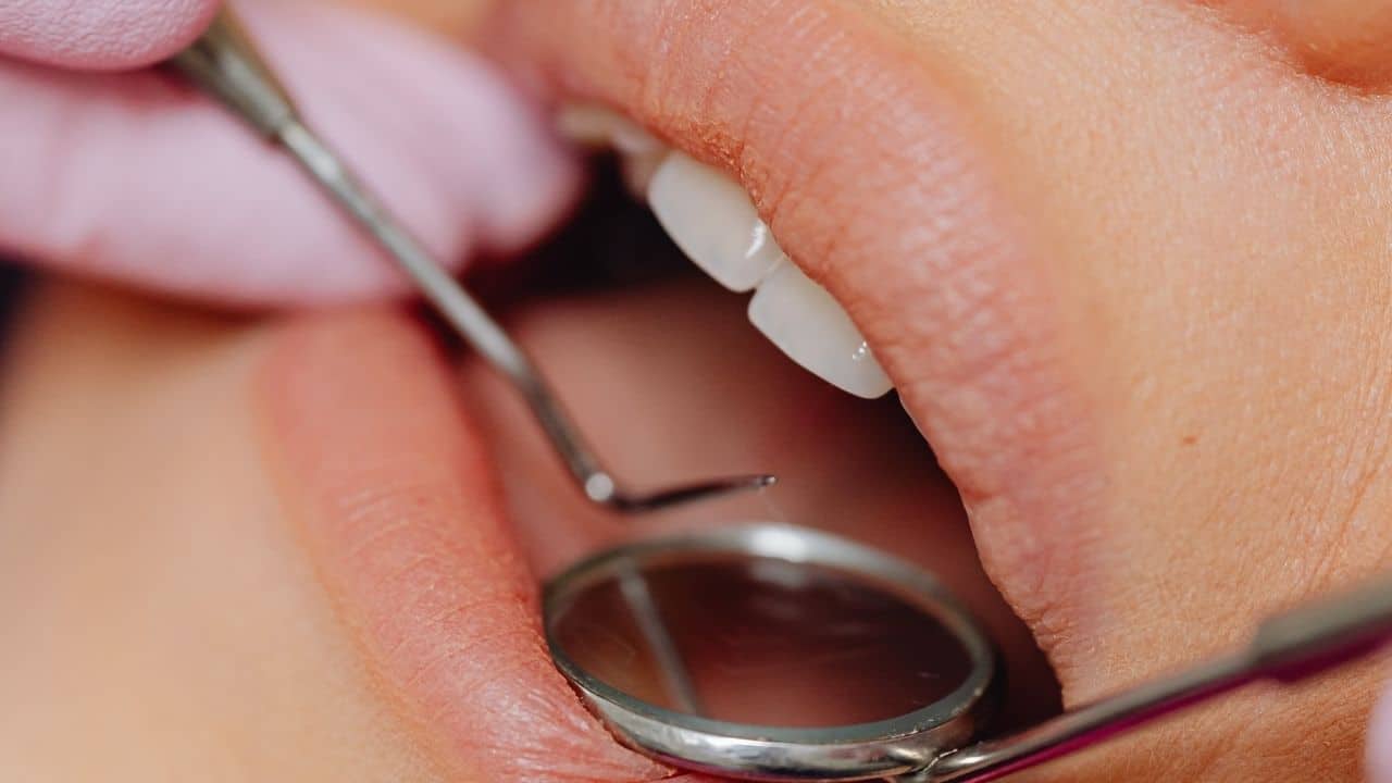 dental check up in nottingham