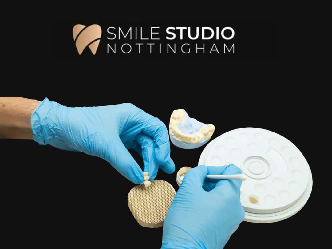 Same-Day Denture Repair in Nottingham